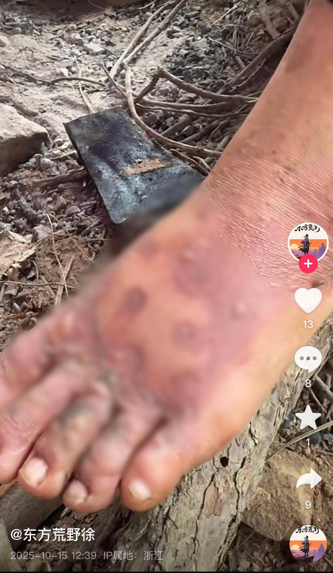 浙江瑞安“荒野求生”挑战赛被曝投喂选手、内定获奖者等问题 主办方回应｜封面头条